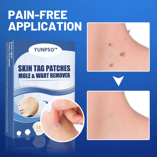 YUNPSO™ Moles & Warts Removing Skin Tag Patch - Image 4
