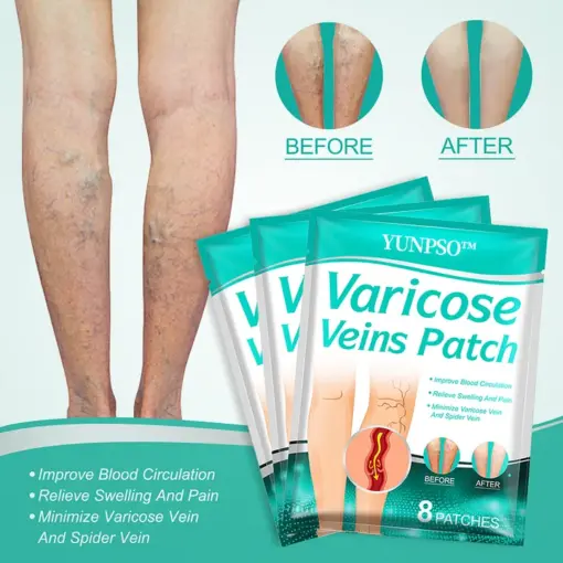 YUNPSO Leech Varicose Veins Patch - Image 3
