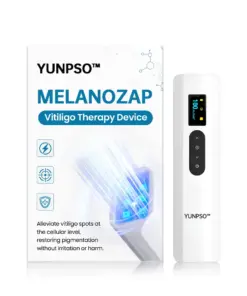 YUNPSO™ MelanoZap Vitiligo Therapy Device