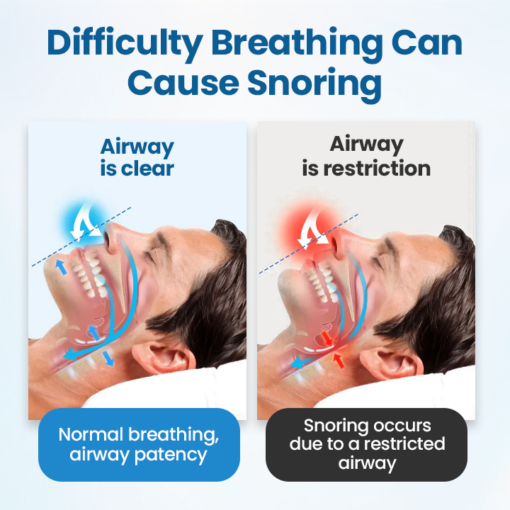 YUNPSO™ SnoreLess Nasal Breather - Image 5