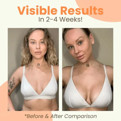 YUNPSO™ Papaya Extract Breast Enhancing Patch - Image 2