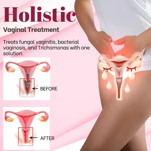 YUNPSO™ Vaginal Detox Spray - Image 2
