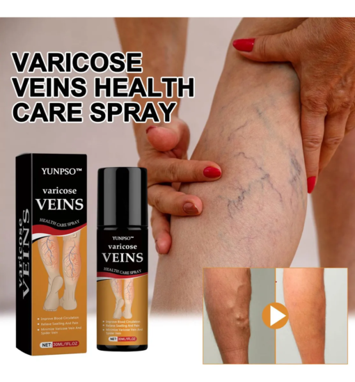 YUNPSO Turmeric Varicose Veins Relief Spray