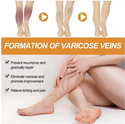 YUNPSO Turmeric Varicose Veins Relief Spray - Image 2