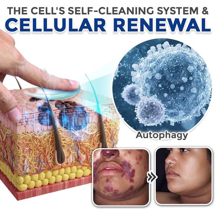 YUNPSO™ Spermidine Autophagy Comprehensive Cream - Image 3