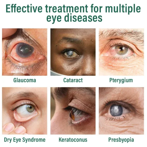 YUNPSO™ Nano Eye Drops Serum - Image 4