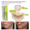 Yunpso® Botox & Vita-A Retinol Shot Wrinkle-Lift Tightening cream