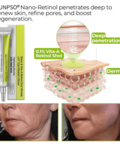 Yunpso® Botox Vita-A Retinol Shot Wrinkle-Lift Tightening cream - Last Day Promotion 70 OFF