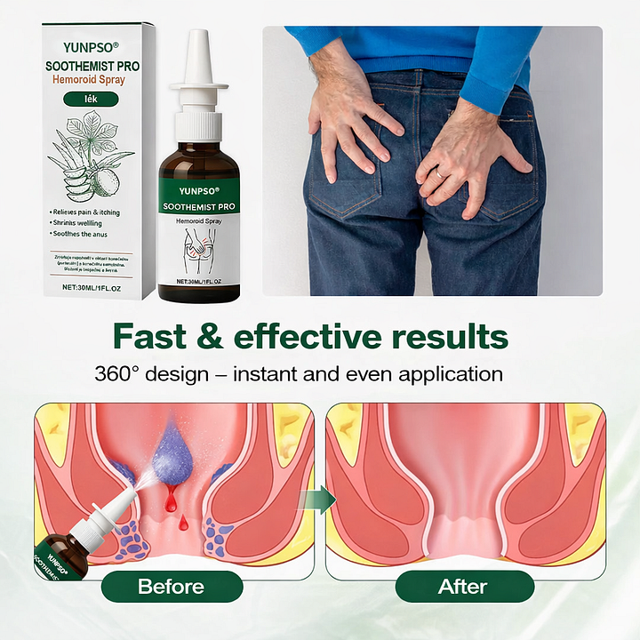 YUNPSO® SootheMist PRO Hemorrhoid Spray - Image 2