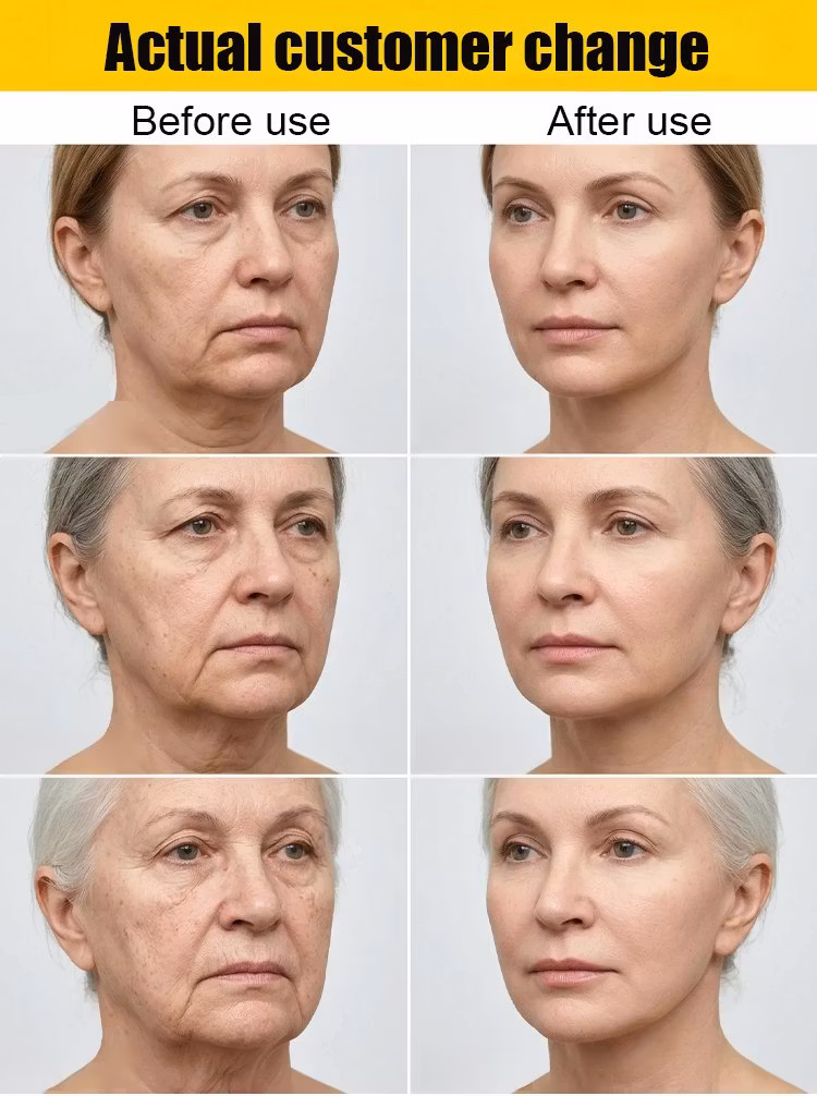 Yunpso™ Collagen Fullerene Neck Cream - Image 3